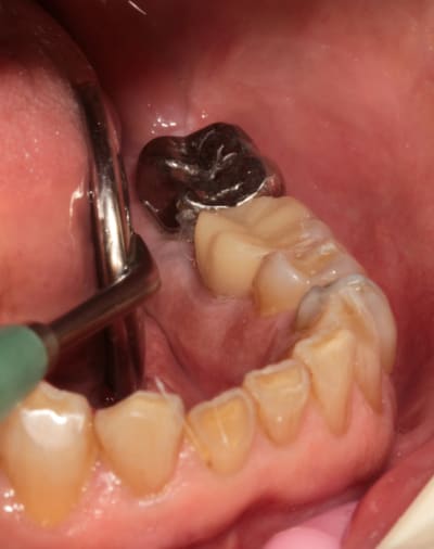 Img 5379 nxfh7l - Eugenol