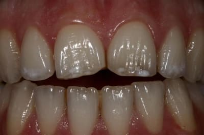 Img 5508  large  jrcw0e - Eugenol