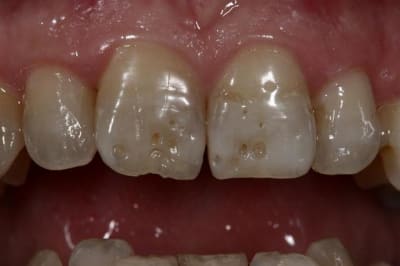 Img 5530  custom  q5ah2g - Eugenol