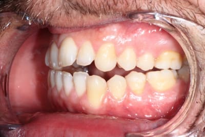 Img 5806 jostkx - Eugenol