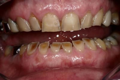 Img 5885  large  euhuzg - Eugenol