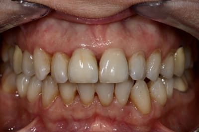Img 5974 bnfkxb - Eugenol