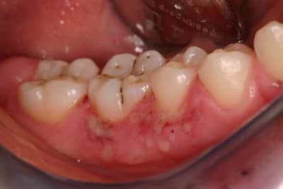 Img 6096 qfbkhy - Eugenol