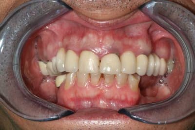 Img 6142 lgw3ar - Eugenol