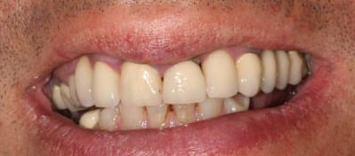 Img 6146 km0hwz - Eugenol