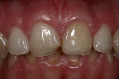 Img 6313  1024x768  puhjvo - Eugenol