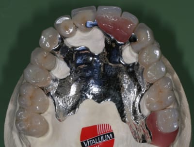 Img 6353 zigqx8 - Eugenol