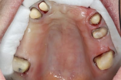 Img 6574 mhoqt7 - Eugenol