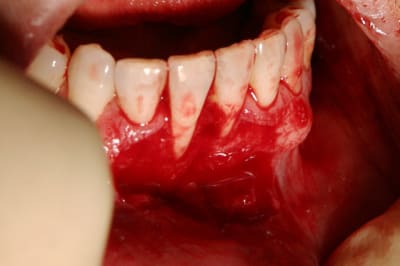 Img 6689 k5aroh - Eugenol