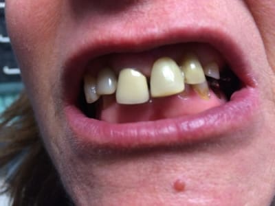 Img 6776 nwmfjt - Eugenol