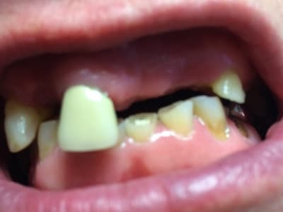 Img 6778 xuv4vu - Eugenol