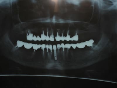 Img 6806 jz0aeg - Eugenol