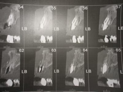 Img 6819 ajyxqk - Eugenol