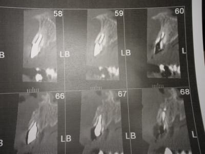 Img 6820 xsporv - Eugenol