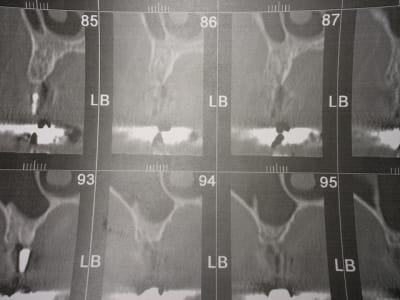 Img 6823 jaglx4 - Eugenol