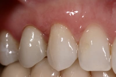 Img 6833 q3ahob - Eugenol