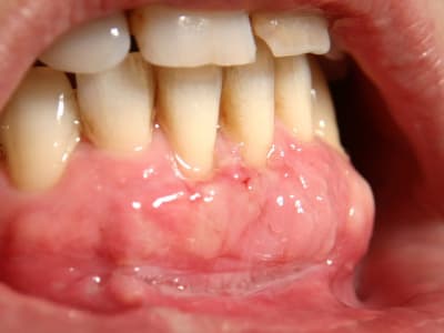 Img 6946 gzxdcg - Eugenol