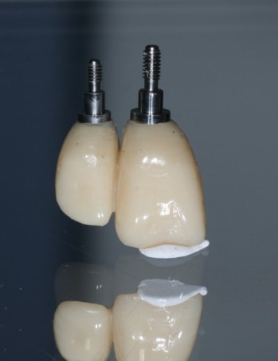 Img 6961 pjmxwd - Eugenol