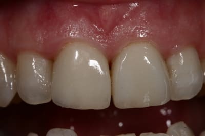 Img 7143 a5mmgn - Eugenol