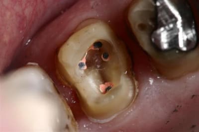 Img 7207  custom  lbkcmt - Eugenol