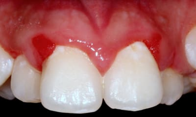 Img 7274 dvx3li - Eugenol