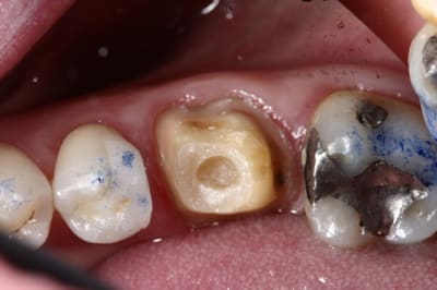 Img 7282 zlqqus - Eugenol