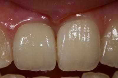 Img 7597  large  nlyioe - Eugenol
