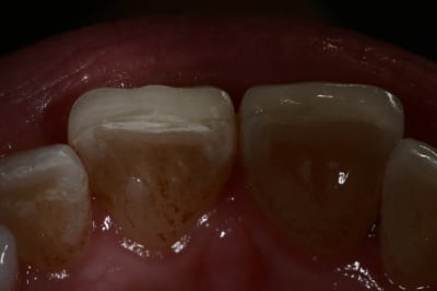 Img 7607 il9k29 - Eugenol