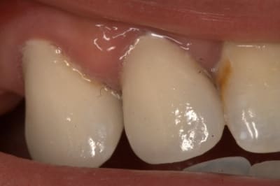 Img 7619 x0dkjr - Eugenol