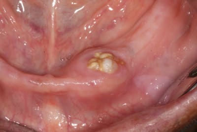 Img 7822 ei1lmg - Eugenol