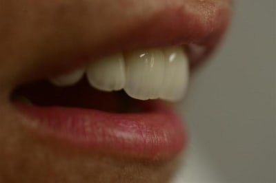 Img 7825  custom  dz7nxr - Eugenol