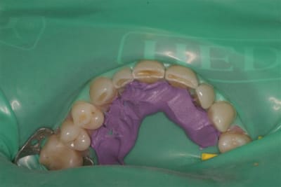 Img 8107 2  small  gqmtql - Eugenol