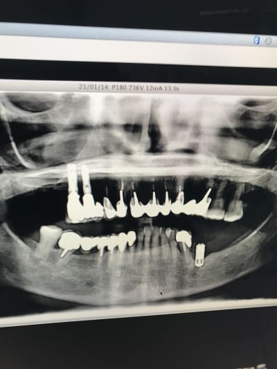 Img 8282 31918 uyoikw - Eugenol
