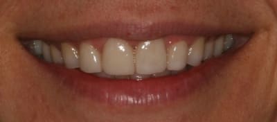 Img 8526 r5qozo - Eugenol