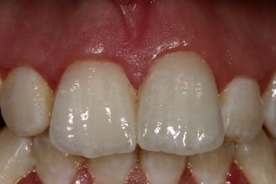 Img 8777 zlqumv - Eugenol