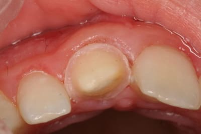 Img 8866 jqnqzd - Eugenol