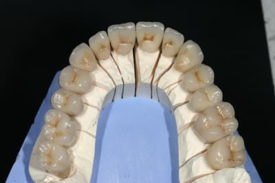 Img 9026 ivmc4z - Eugenol