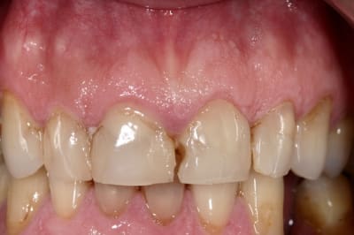 Img 9156 kjtkod - Eugenol