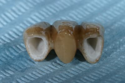 Img 9333 iony5e - Eugenol