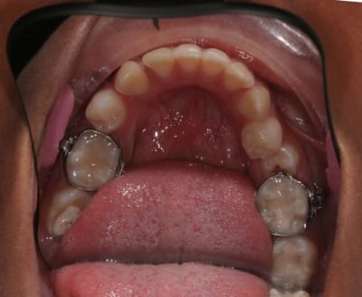 Img 9417 v8rper - Eugenol