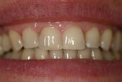 Img 95592 wgeu7j - Eugenol