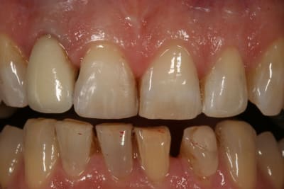 Img 9763 ncmpiz - Eugenol