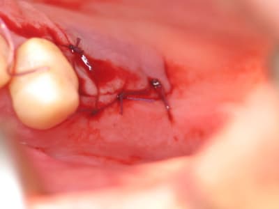 Img 9768 fkumow - Eugenol