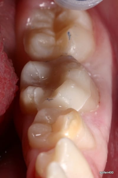 Img 9916 p0qhrt - Eugenol