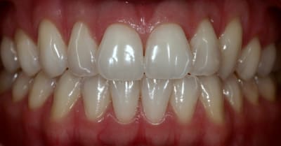 Img 9960 ujomqu - Eugenol