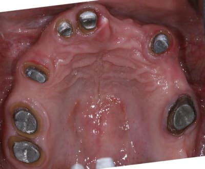 Img ic1 r9efqt - Eugenol
