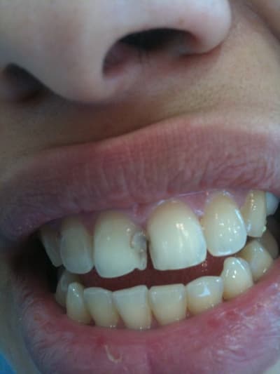 Iphone 068 zkaoqh - Eugenol