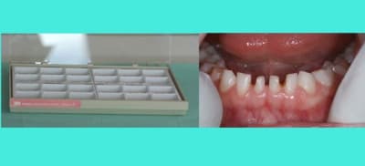 Image 1 ecpvuy - Eugenol