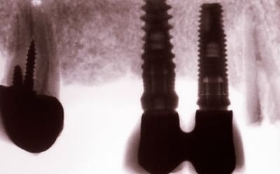 Image0001 qbyvhl - Eugenol