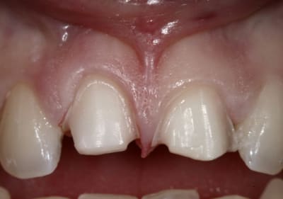 Image10 dmxrre - Eugenol